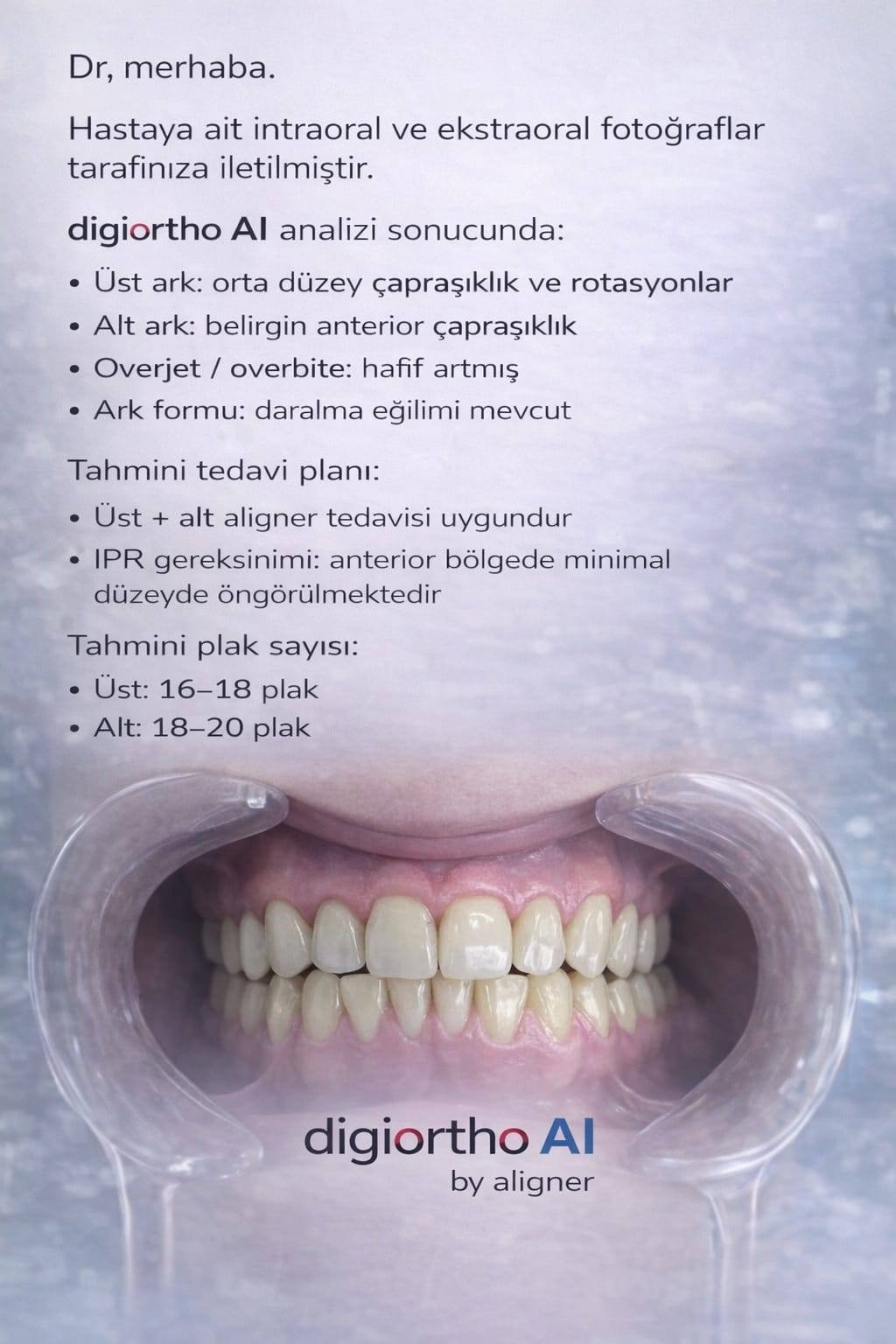 DigiOrtho AI tedavi planı raporu