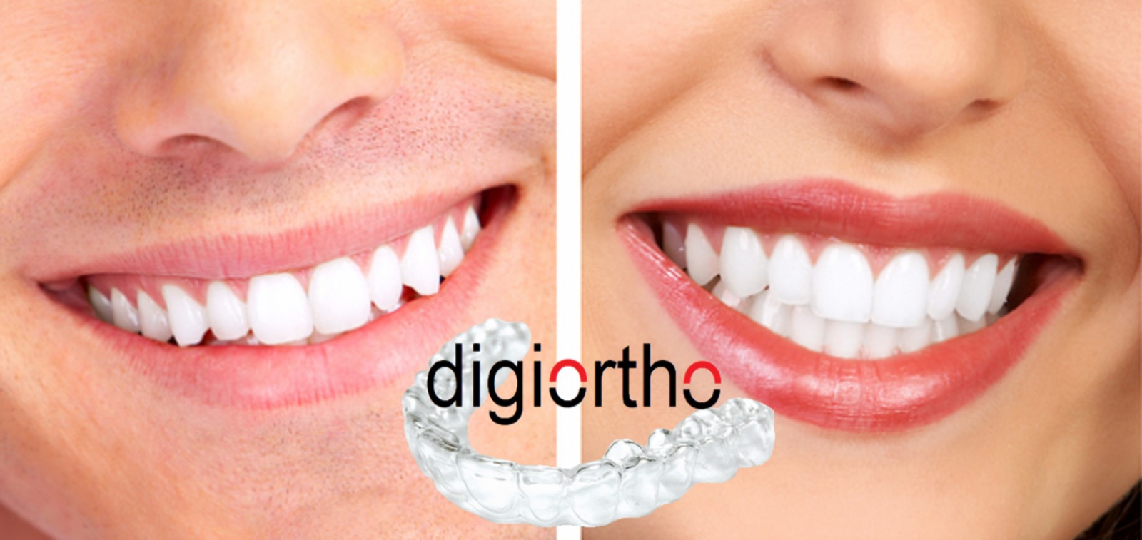 DigiOrtho tedavi sonuçları