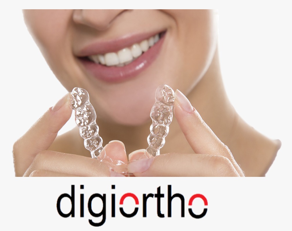 DigiOrtho şeffaf plak sistemi