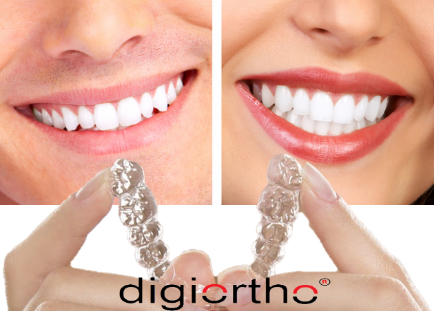 Digiortho nedir ?